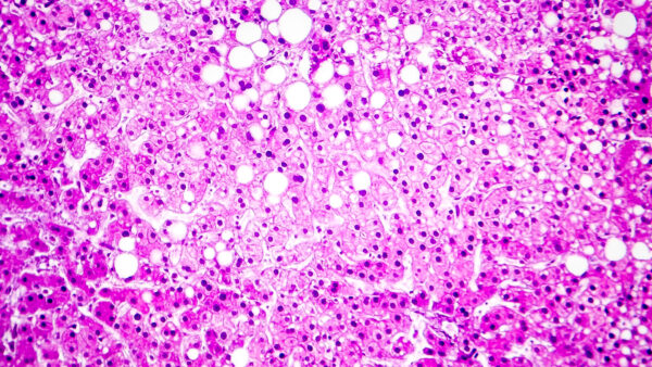 Histopathology Staining Assay Services